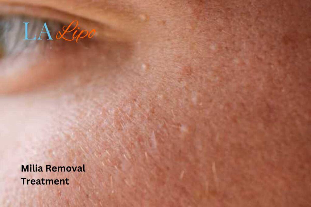 When It’s Time to See a Professional Brentwood?