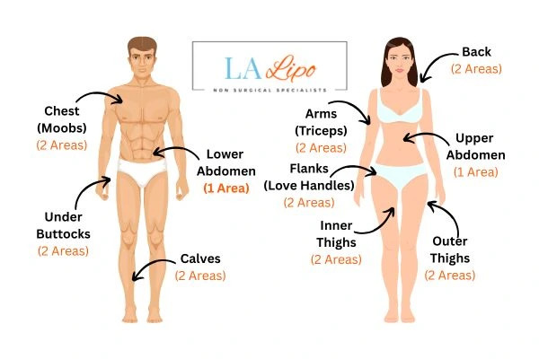 LA LIPO Cryolipolysis Areas Brentwood