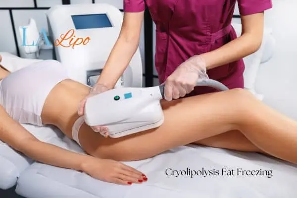 Woman receiving coolsculpting Brentwood treatment on her thighs