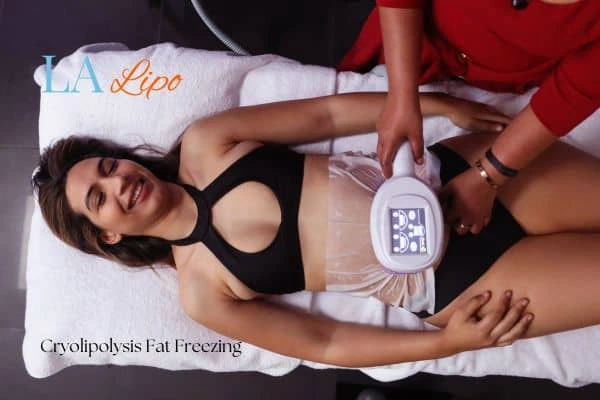 woman getting cryolipolysis Brentwood
