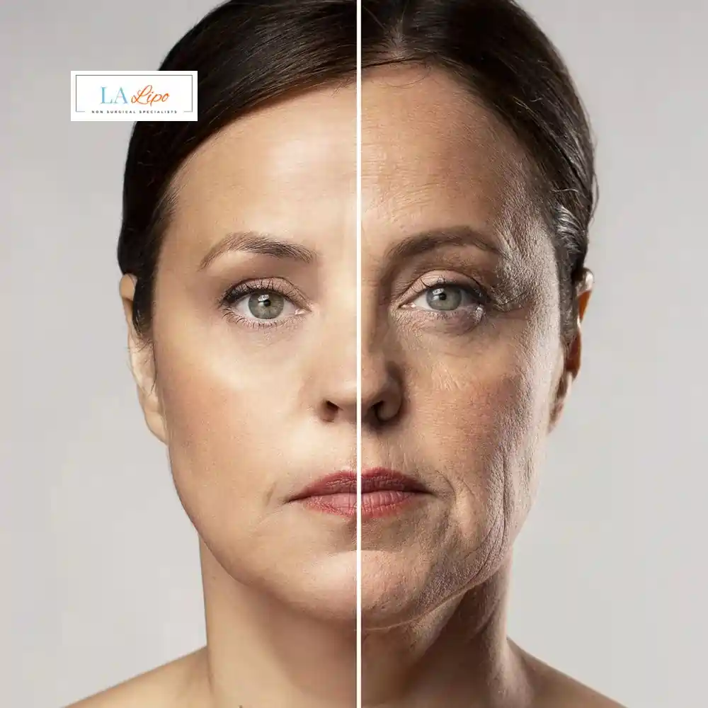 How Can You Tell If Non-Surgical Skin Tightening Is Right for You Brentwood?