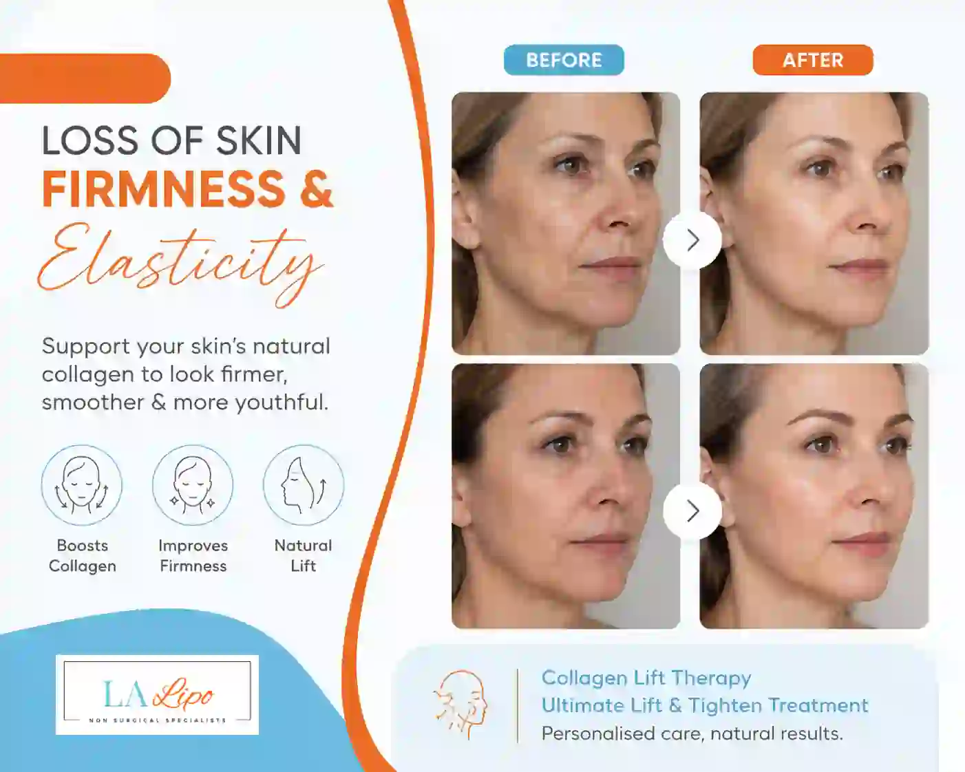 Sign #7: Loss of Skin Firmness and Elasticity Brentwood